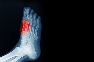 The Function of the Sesamoid Bones