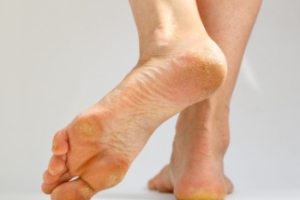 Pain in the Bottom of the Foot